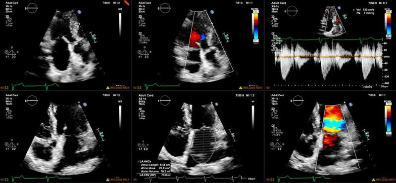 Cardiovascular Diagnostic Interpretation - Timely and accurate interpretations of electrocardiograms, echocardiograms, and ...